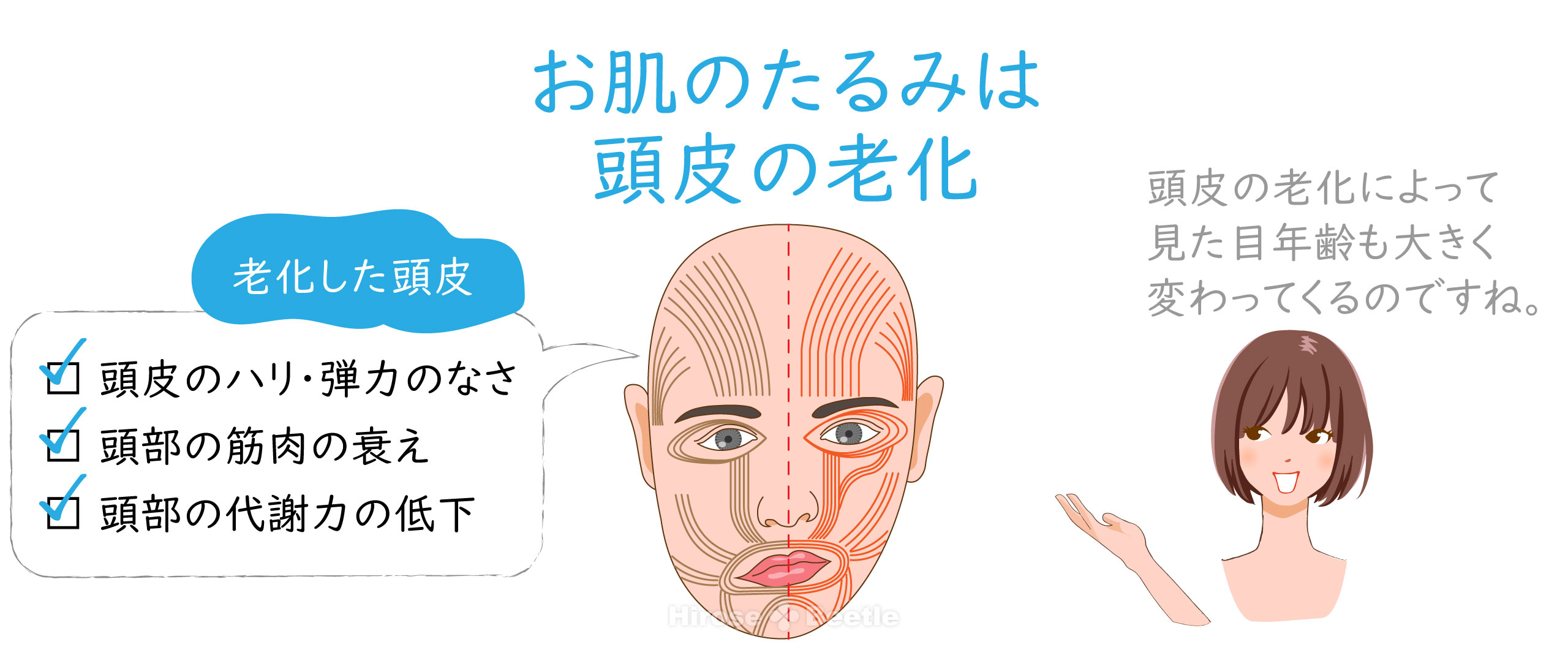 顔のたるみの原因は頭皮の老化