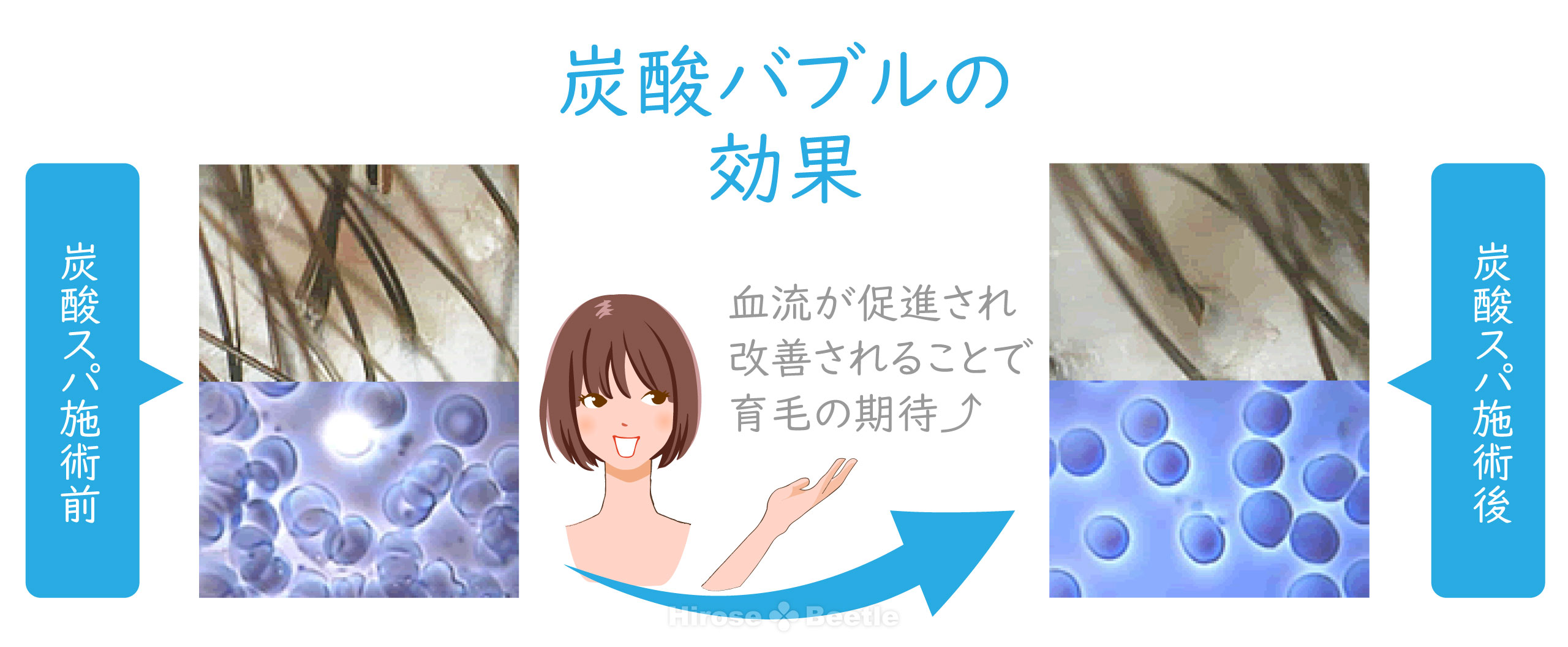 薄毛が気になる