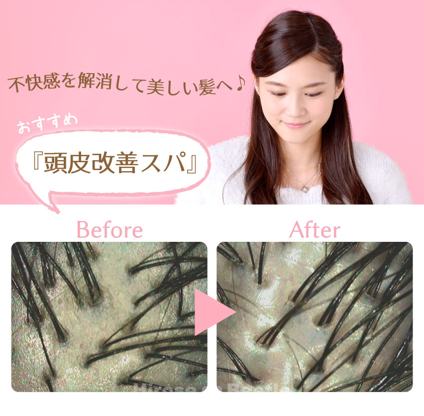 ヘッドスパ